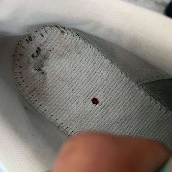 Kısa Sürede Taban Boşalan Ve Yanları Açılan Puma Ayakkabı İçin İade Reddi Ve İletişimsizlik