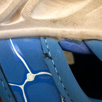 Skechers Çocuk Ayakkabısının 2 Ayda Soyulması Ve İade Reddi
