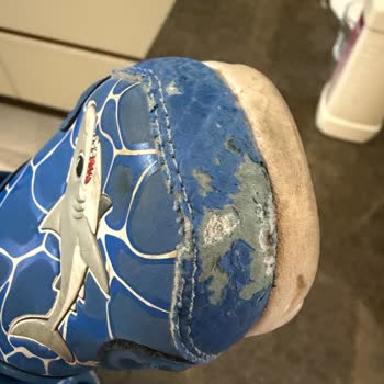 Skechers Çocuk Ayakkabısının 2 Ayda Soyulması Ve İade Reddi