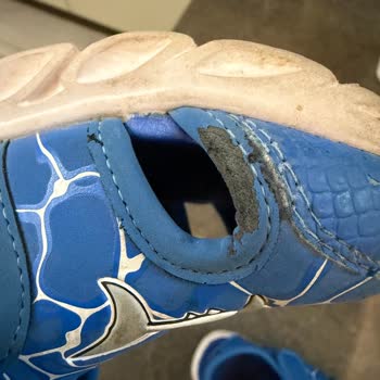 Skechers Çocuk Ayakkabısının 2 Ayda Soyulması Ve İade Reddi
