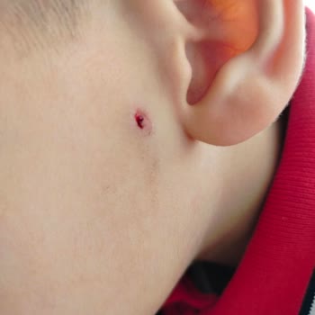 Okulda Çocuğuma Yönelik Fiziksel Şiddet Ve Güvenlik Endişesi