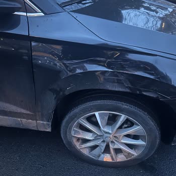 Axa Sigorta’da Trafik Sigortası Hasar Dosyamın Gecikmesi Ve Sonuçlanmaması