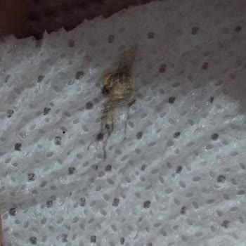 Bebek Bezinde Böcek: Hijyen Ve Güven Sorunu