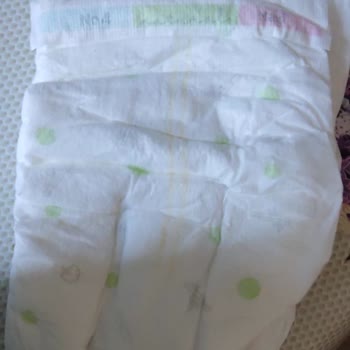 Sleepy H2O Bebek Bezinde Yanlış Seri Ve Şiddetli Pişik Şikayeti