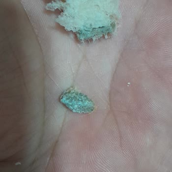 Mavikent Belediyesi Halk Ekmeğinde Küflü İç Doku Ve Sağlık Tehlikesi
