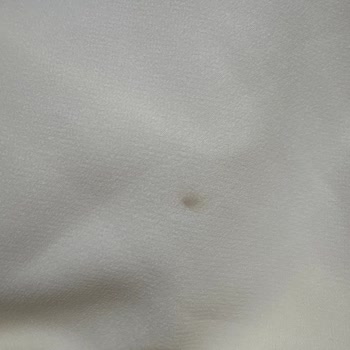 Özel Günüm İçin Siparişim Kargoda Kayboldu, Yanlış Beden Ve Lekeli Ürün