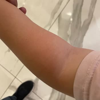 Acil Bölümde Bebek Hemşiresi Yokluğu Ve Tekrarlayan Damar Açma Hataları Çocuğu Mağdur Etti