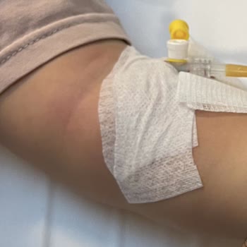 Acil Bölümde Bebek Hemşiresi Yokluğu Ve Tekrarlayan Damar Açma Hataları Çocuğu Mağdur Etti