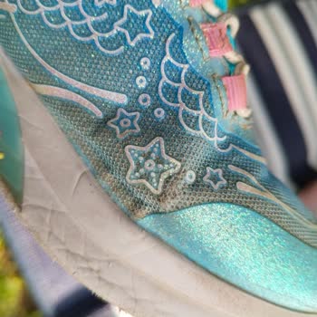 Skechers Çocuk Ayakkabısında Az Kullanıma Rağmen Hızlı Aşınma Ve Mağazanın Kullanıcı Hatası İddiası