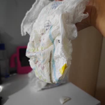 Molfix 6 Numaralı Külot Bezlerde Emme Sorunu Ve Ürün Değişimi Talebi