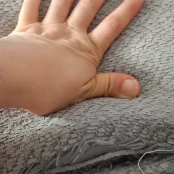 Kırık Koltuk Takımı Ve Verilen Değişim Sözünün İhlali