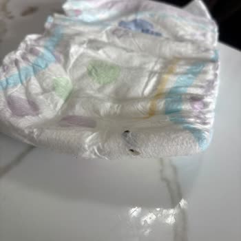 Molfix Bebek Bezinde Böcek Tespiti