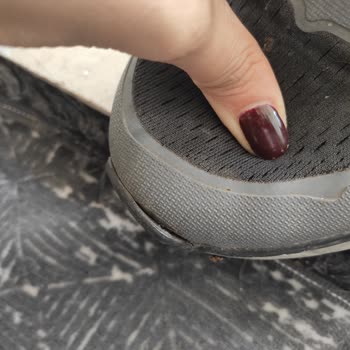 Skechers Ayakkabılarında Tekrarlayan Yırtılma Ve Çözüm Sunulmaması