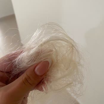 Ruken Güler Kuaför Saç Dökülmesi ve Yanma Görüntüsü Devam Ediyor