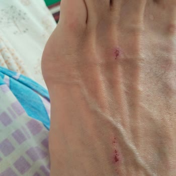 Ayak Yaralayan Bambi Terlik İçin İade Ve Değişim Talebi