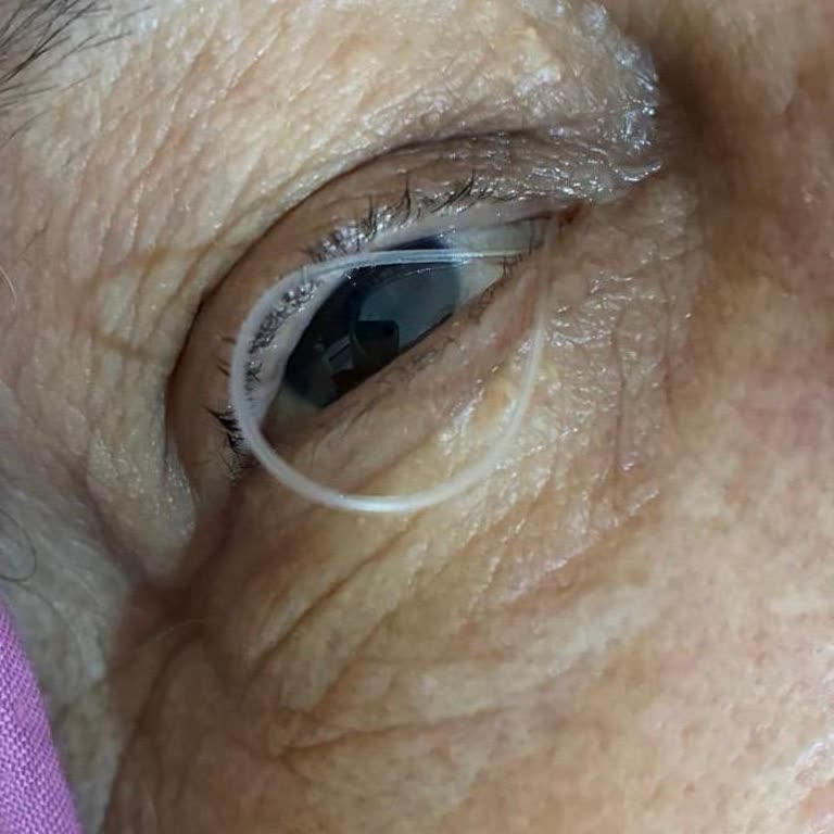 Ameliyat Sonrası Takipte Doktorun İlgisizliği Ve Yetersiz Müdahalesi
