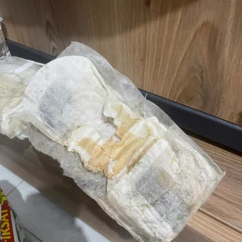 Molped Hijyenik Pedde Küflenmiş Ürün Şikayeti
