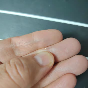 BİM Patates Cipsinde Metal Tel Bulunması Sağlık Riski Ve Denetim Talebi