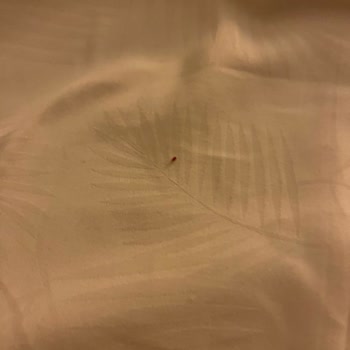 Walk Inn Hotel’de Tahta Kurdu İle Karşılaşılan Hijyen Skandalı Ve Obilet’in İade Reddine Tepki