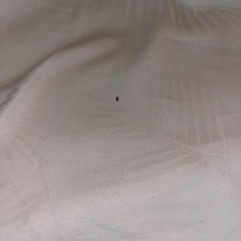 Walk Inn Hotel’de Tahta Kurdu İle Karşılaşılan Hijyen Skandalı Ve Obilet’in İade Reddine Tepki