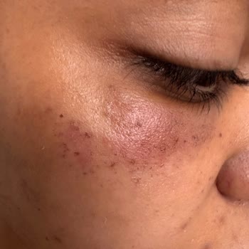 Dr. Deniz Kaplan Muayenehanesi Sorun Yaşama