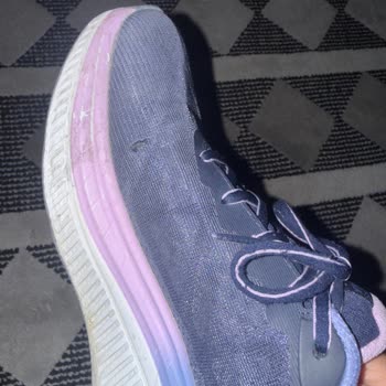 Yüksek Fiyatlı Skechers Ayakkabısında Kısa Sürede Yırtılma Ve Üretim Hatası Reddi