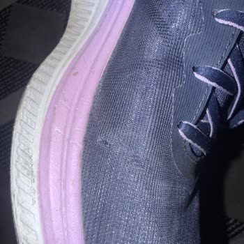 Yüksek Fiyatlı Skechers Ayakkabısında Kısa Sürede Yırtılma Ve Üretim Hatası Reddi