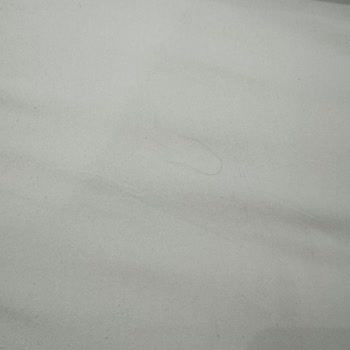 Hijyen Sorunu Yaşanan Oda İçin Ücret İadesi Ve Sorumluluk Reddi