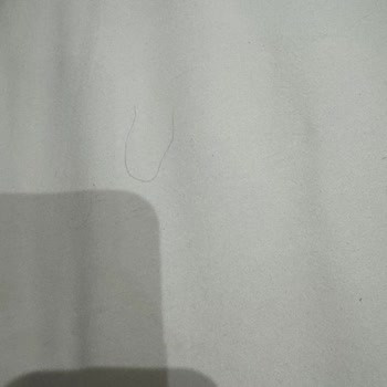 Hijyen Sorunu Yaşanan Oda İçin Ücret İadesi Ve Sorumluluk Reddi