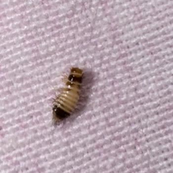 Bebek Bezinde Larva Görüldü: Acil Değişim Ve Sorumluluk Talebi