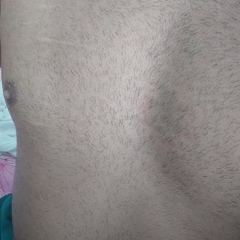 Ürünün Etkisizliği Ve Ciltte Kızarıklık Nedeniyle İade Talebi