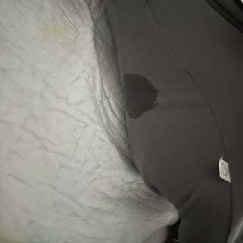 Molfix 1 Ve 2 Numaralı Bezlerde Sürekli Çiş Kaçırma Sorunu