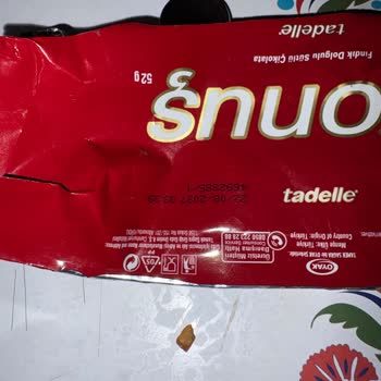 Migros King Size Tadelle Çikolatasındaki Sert Kabuk Diş Etine Zarar Verdi