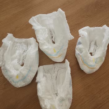 Molfix 7 Numaralı Bezlerde Yan Kenar Yırtılması Ve Kalite Sorunu