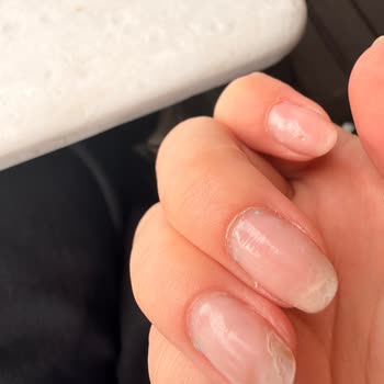 Flormar Rubber Vanish Ojesinde Kuruma Ve Çözülme Sorunu