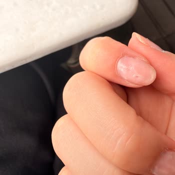 Flormar Rubber Vanish Ojesinde Kuruma Ve Çözülme Sorunu
