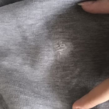 Baggy Style'dan Gelen Ayıplı Hırka Ve Cevapsız İade Talebi