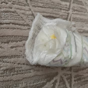 Molfix 4 Numara Külot Bezde Dolgu Malzemesinin Dışarı Taşması Ve Çocuk Cildine Yapışması