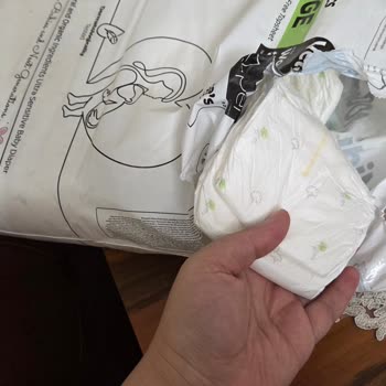 Sleepy Bebek Bezinde Şiddetli Koku Ve Sağlık Endişesi