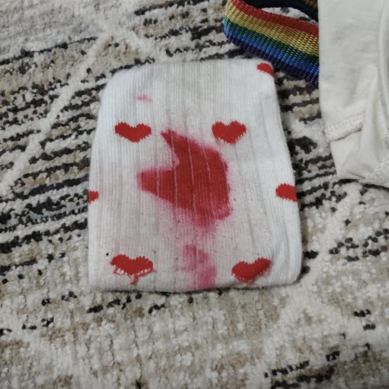 Desenli Çorapta Boya Sızıntısı Ve Değişim Talebi