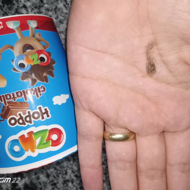 Çocuğa Satılan Çikolatada Kıl Yumağı Çıktı Ve Güvenimiz Sarsıldı