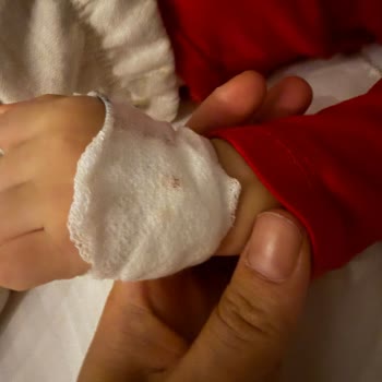 Çocuğumun Damarına Yapılan Serum Müdahalesi Sonrası Yaralanma Ve Hastane İhmali, İnceleme Talebi
