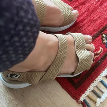 Skechers Sandaletimde Ağır Kusur Ve Kargo Teslimi Sorunu
