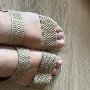 Skechers Sandaletimde Ağır Kusur Ve Kargo Teslimi Sorunu