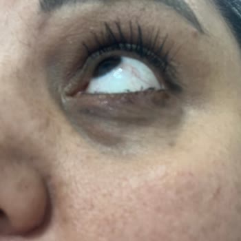 Kiko Maxi Rimelin Akması Ve İade Sürecinin Cevapsız Kalması
