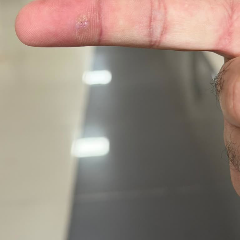 Mavi Hastane Plastik Cerrahi Bölümünde Randevu Değişikliği Ve Uzun Bekleme Mağduriyeti
