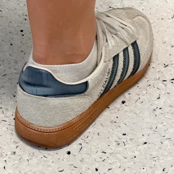 Adidas Ayakkabısında Hızlı Renk Solması Ve İnceleme Redleri