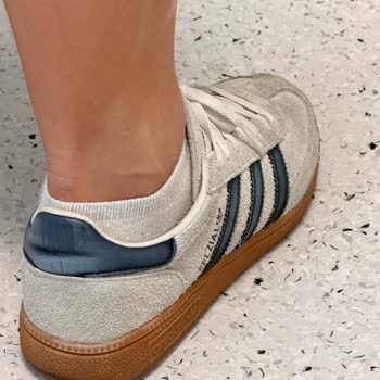 Adidas Ayakkabısında Hızlı Renk Solması Ve İnceleme Redleri