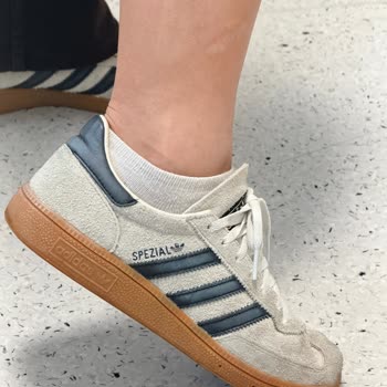 Adidas Ayakkabısında Hızlı Renk Solması Ve İnceleme Redleri