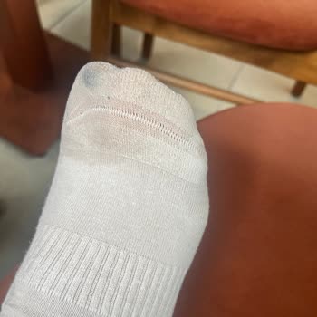Su Geçirmez Olmadığını Gösteren Skechers Ayakkabı Kullanıcıyı Mağdur Etti